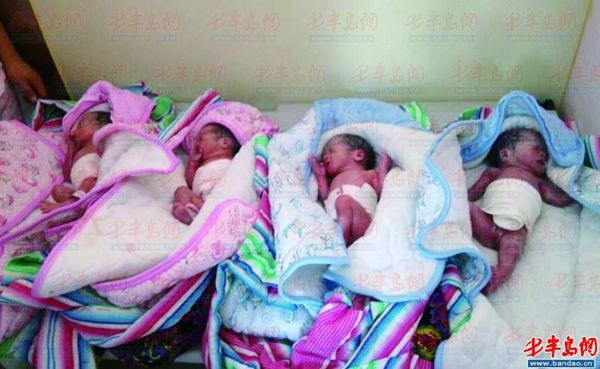 日照产妇在青生下四胞胎 孩子住院要花二十万